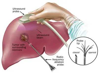Liver