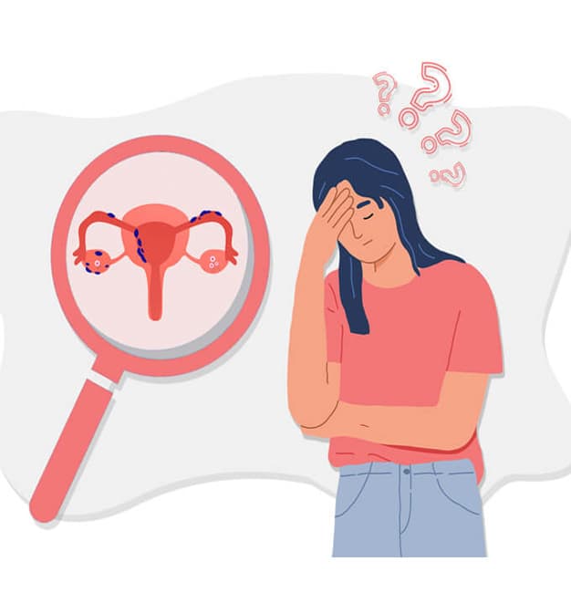 Female Infertility