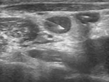 Image-Guided Diagnostic & Therapeutic Procedures