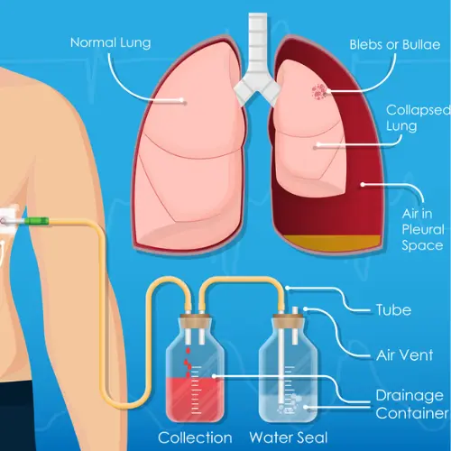 Chest & Lung Conditions