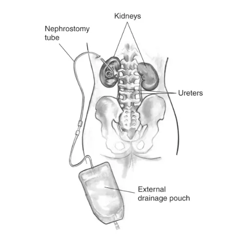 Kidney & Urinary Conditions