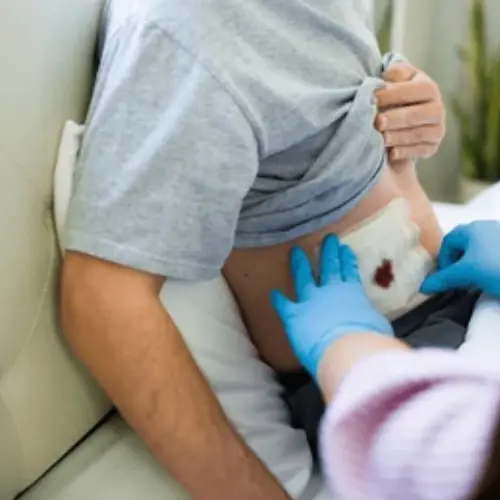 Post-Surgical or Trauma Collections