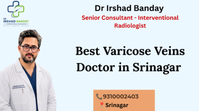 Best Varicose Veins Doctor in Srinagar