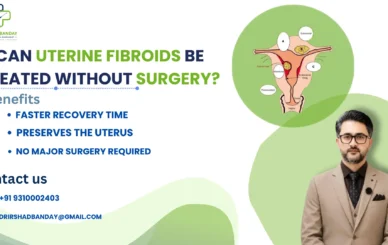 Can Uterine Fibroids Be Treated Without Surgery?