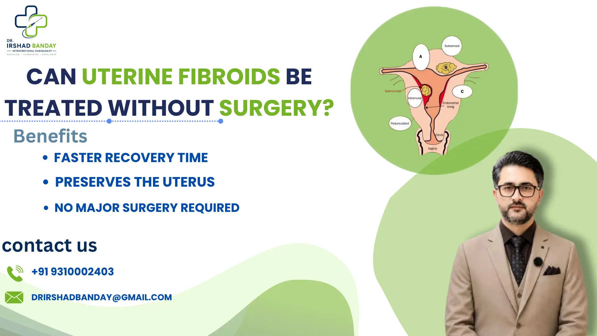 Can Uterine Fibroids Be Treated Without Surgery?