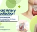 Thyroid Artery Embolization