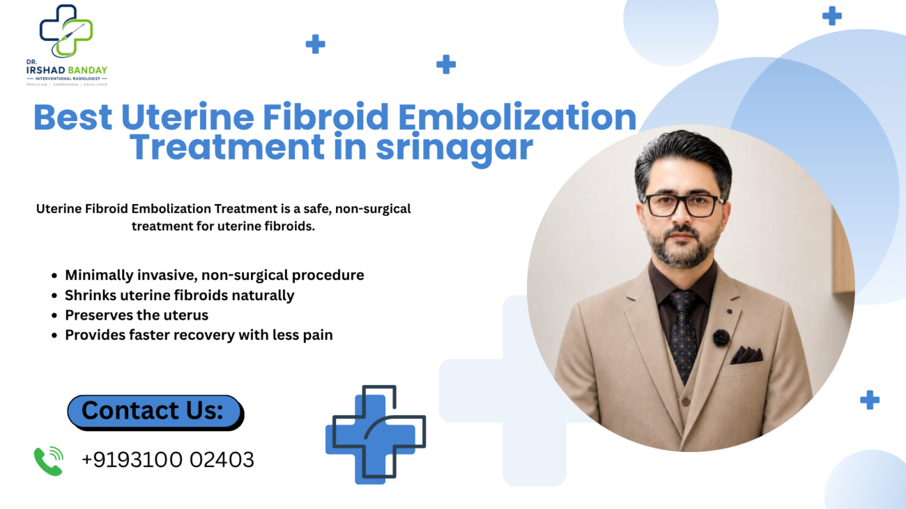 Uterine Fibroid Embolization Treatment