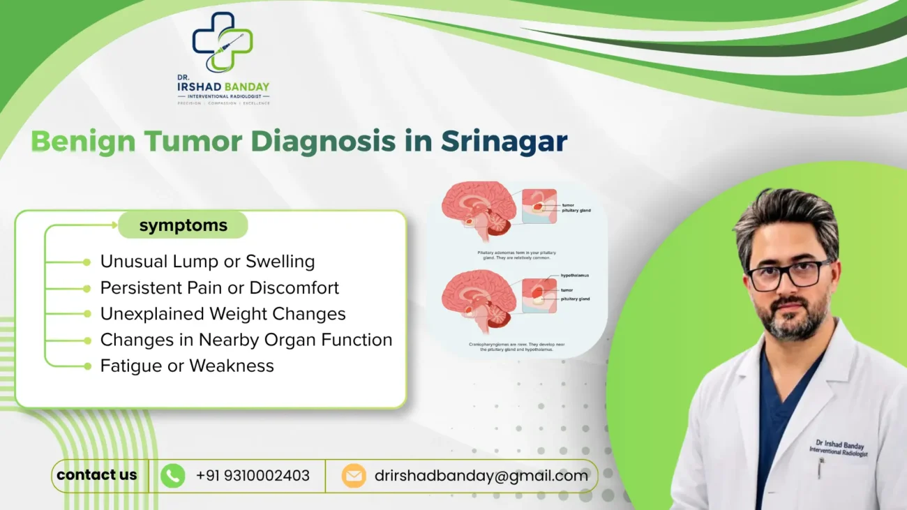 Benign Tumor Diagnosis in Srinagar