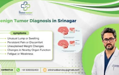 Benign Tumor Diagnosis in Srinagar