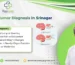 Benign Tumor Diagnosis in Srinagar