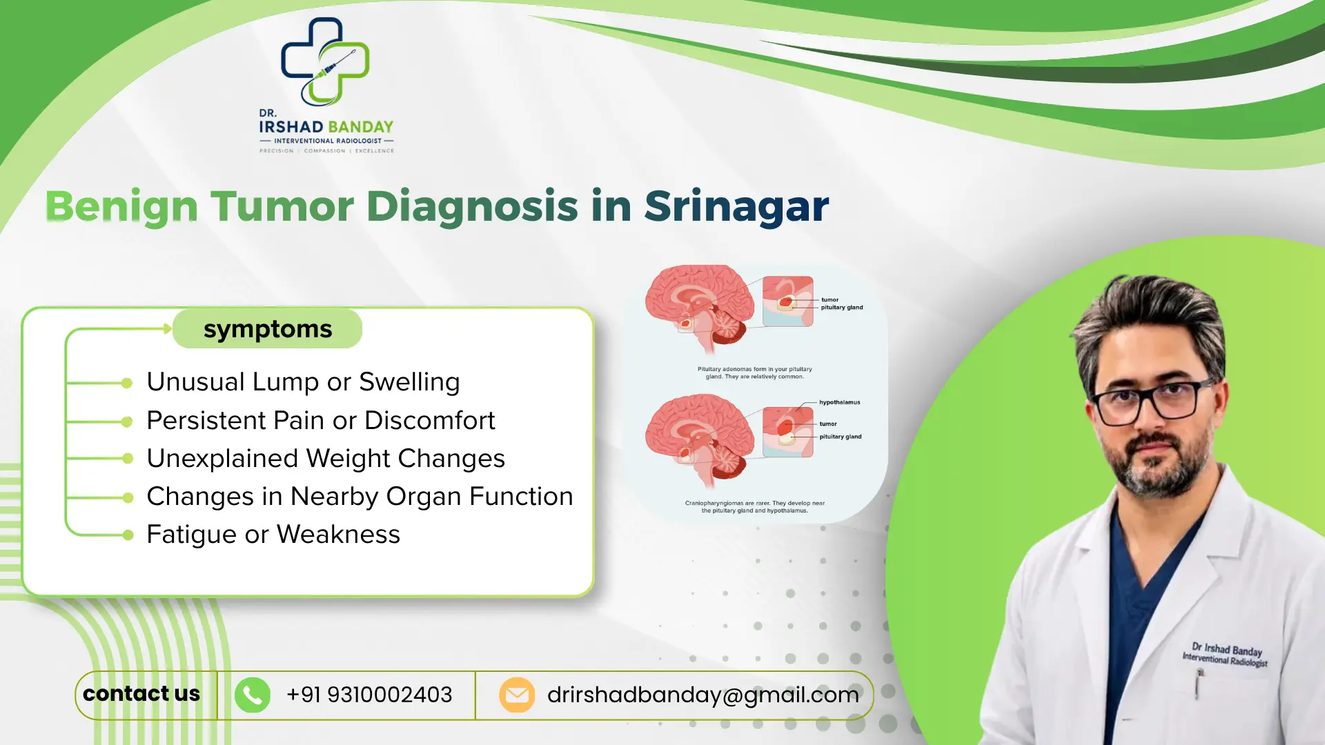 Benign Tumor Diagnosis in Srinagar