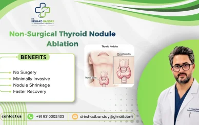Non-Surgical Thyroid Nodule Ablation: Benefits & Risks