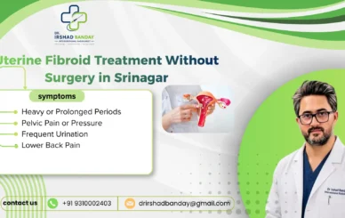 Uterine Fibroid Treatment Without Surgery in Srinagar